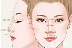 鼻唇溝怎么填充？鼻唇溝是如何形成的？
