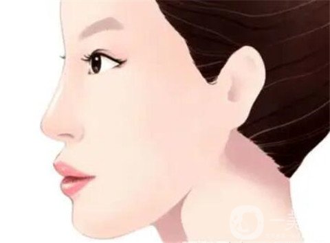 湖南省人民醫(yī)院整形美容科隆鼻*果如何？看價(jià)格表及案例實(shí)述