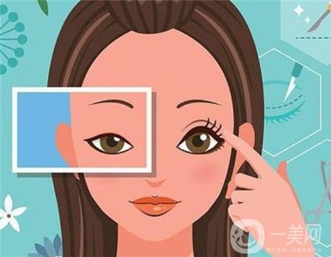 割完雙眼皮之后一個月時間能完全恢復(fù)嗎