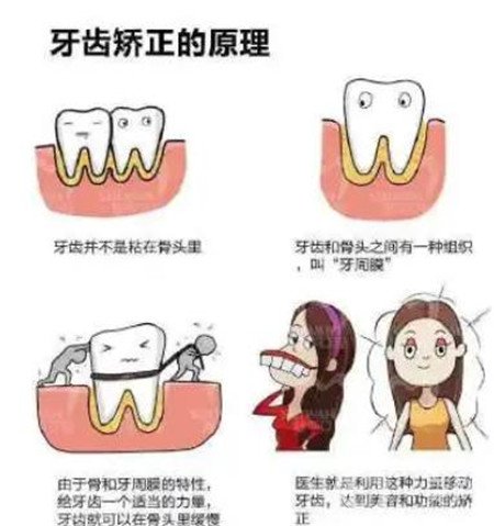 貴陽口腔醫(yī)院整牙貴嗎?正畸價格表及案例一覽