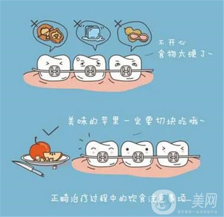貴陽口腔醫(yī)院整牙貴嗎?正畸價格表及案例一覽