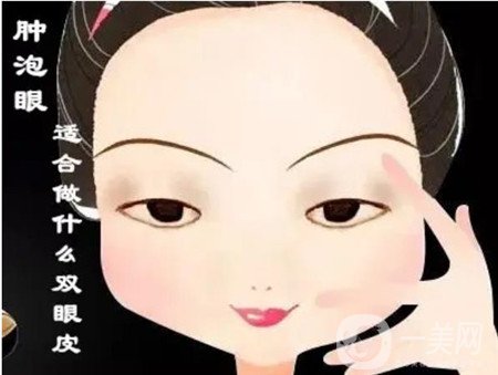 北京處靳小雷怎么預(yù)約？雙眼皮修復(fù)案例及整形價(jià)格表