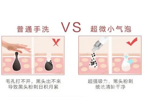 哈醫(yī)大四院整形美容科價格表2020更新，附小氣泡案例