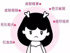 射頻緊膚需要多少錢？有什么副作用？