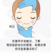 抽脂減肥后的疼痛怎么緩解？面部可以抽脂嗎？