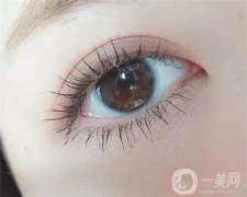 眼袋手術(shù)后需要多長(zhǎng)時(shí)間恢復(fù)？