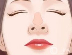 鼻小柱延長(zhǎng)怎么修復(fù)?怎么護(hù)理?