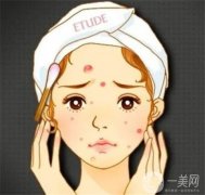 有哪些類型的？做激光會(huì)損傷皮膚嗎？