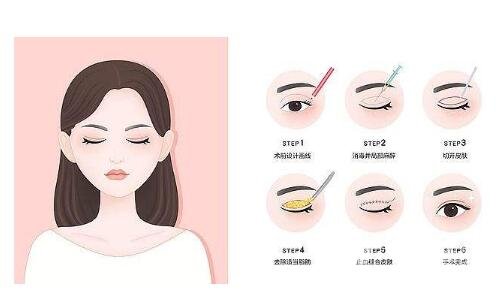 好看的雙眼皮