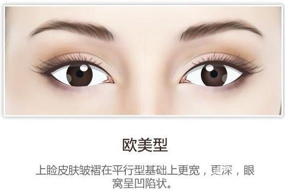 開眼角后疤痕增生怎么辦？