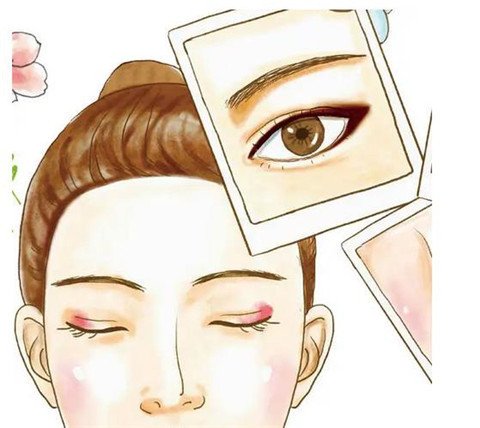 割雙眼皮疼嗎？有多疼？