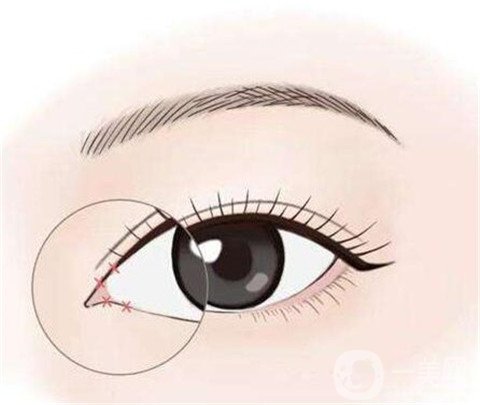 開內(nèi)眼角多久可以化妝？