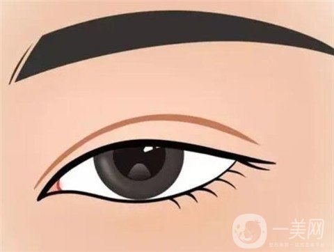 關(guān)于開(kāi)眼角和割雙眼皮 這些你都了解嗎？