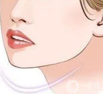 玻尿酸填充下巴有什么副作用嗎？