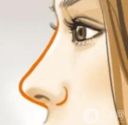 南京醫(yī)科大學(xué)友誼醫(yī)院整形外科價格表，附隆鼻案例圖