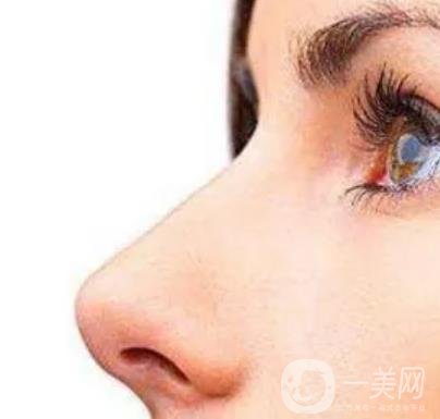 玻尿酸隆鼻價(jià)格是多少 玻尿酸隆鼻方法
