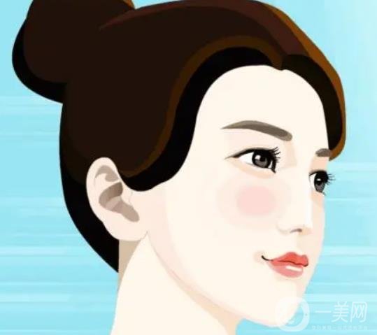 假體下巴多久恢復(fù)？恢復(fù)過(guò)程怎樣的？