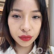 眼袋的形成讓我脾氣變得暴躁起來(lái)，父母說(shuō)我是因?yàn)橥ㄏ蛘呤菒劭薏虐l(fā)生的