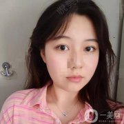 大家都說臉上有疤的人，小時(shí)候一定會(huì)皮，我爸媽都管不住我