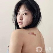 對(duì)于我們這種身上有疤的人來說，每一塊地方都是一個(gè)特別痛苦的回憶