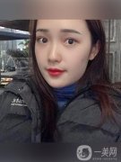大家都讓我出一期熱瑪吉的視頻，但是我還沒有做過熱瑪吉的手術