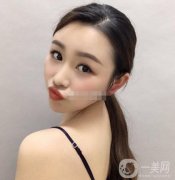除皺:面診的時候，醫(yī)生也是的專業(yè)，說出了本人的問題，結(jié)合問題做出了方案