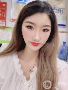 本身就是大眼睛那種，可是的缺點(diǎn)就是小內(nèi)雙