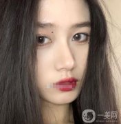 近聽我的朋友說，熱瑪吉特別的火，他是一個(gè)抗衰老的項(xiàng)目