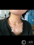 脖子真的就是女人的第二張臉，所以大家在保養(yǎng)自己臉蛋的同時(shí)，也不要忘記自