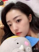醫(yī)生也是建議本人做個拉皮的項目，看了許多案例，感覺做出來效果相當不錯