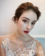才發(fā)現(xiàn)我的毛囊已經(jīng)完全壞死，也只能通過植發(fā)來進(jìn)行解決了