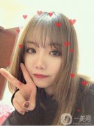 本來還是有一些單眼皮的，就是眼睛有點(diǎn)腫，看起來真的是特別的不好看