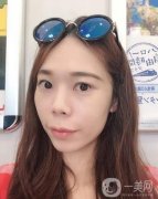 做完熱瑪吉項目已經(jīng)兩個月的時間了，近我還給醫(yī)生發(fā)去了我現(xiàn)在的照片