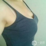 在隆胸拆線之后幾乎我就恢復(fù)了正常的生活了，也可以正常的洗澡了，就是需要