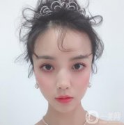 做完隆鼻手術(shù)已經(jīng)有一個(gè)月的時(shí)間了，身邊的朋友看到我都說我的鼻子變好看了