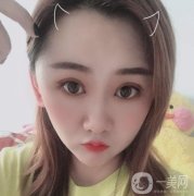 做完拉皮手術(shù)已經(jīng)有兩個(gè)月的時(shí)間了，大家看一下，我是不是有了大的變化