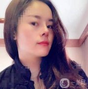電波拉皮去頸紋第三天，并沒(méi)有感覺(jué)到不舒服，我現(xiàn)在只要一有時(shí)間就照鏡子