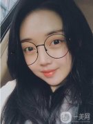建議本人做一個(gè)玻尿酸除皺，當(dāng)時(shí)就下定決心做這個(gè)項(xiàng)目了