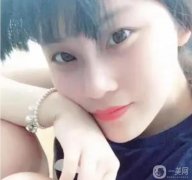鼻子恢復(fù)得很快，沒有嚴(yán)重的腫脹期,現(xiàn)在很喜歡我的鼻子形狀