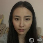 拉完皮也沒(méi)有出現(xiàn)那凹凸不平的現(xiàn)象，真的是越來(lái)越了