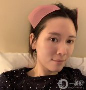 做完熱瑪吉，臉部的整體輪廓特別的明顯