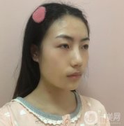 熱瑪吉這個項目真的是特別的神奇，皮膚是越來越穩(wěn)固