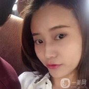 熱瑪吉真的是現(xiàn)在流行的抗衰項目了
