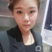 熱瑪吉這個(gè)項(xiàng)目，主要是刺激膠原蛋白的再生