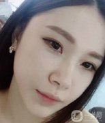 自從做了拉皮手術(shù)之后，已經(jīng)不止一個人夸我年輕了