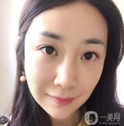 做完熱瑪吉之后，整體的輪廓也是越來越緊致了