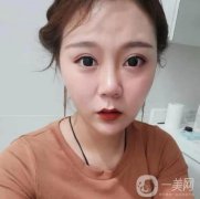 做完熱瑪吉有幾天了，沒有任何不舒服的感覺