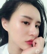 面部填充后，臉摸起來(lái)很軟可以隨意按捏