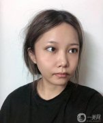 臉部線雕效果好，時(shí)間長(zhǎng)，相對(duì)容易接受微創(chuàng)