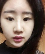 我對(duì)自己的鼻子很清楚，之前一直在微信上和杜達(dá)交流